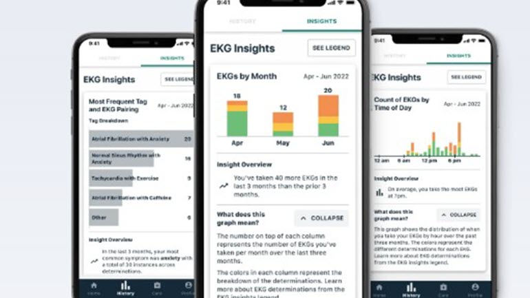 AliveCor Kardia app SaMD