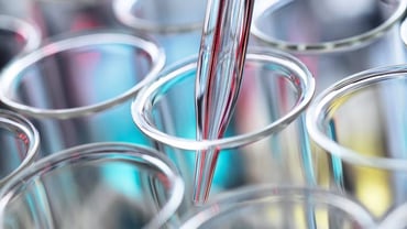 Medical Industry Translation Compliance Under EU AI Act